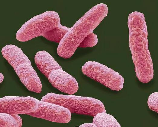 Bacteria Ideonella sakaiensis